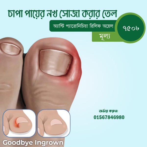 চাপা পায়ের নখ সোজা করার তেল